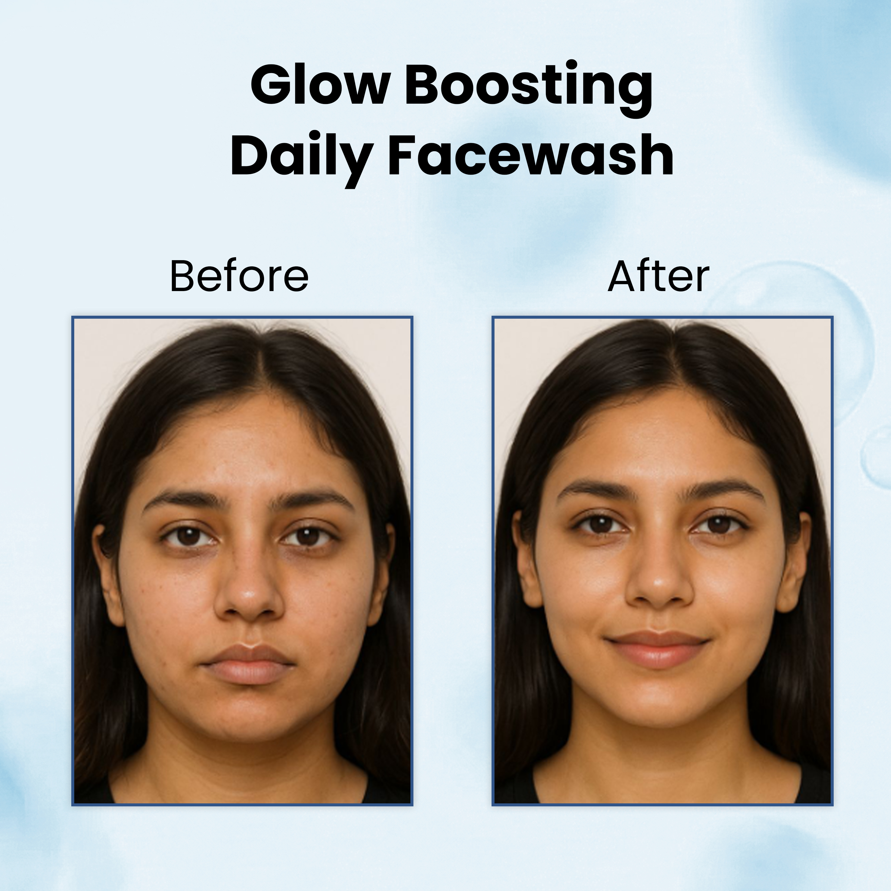 Natually AHA+BHA FaceWash | Glycolic , Salicylic & Hyaluronic Acid - Image 6