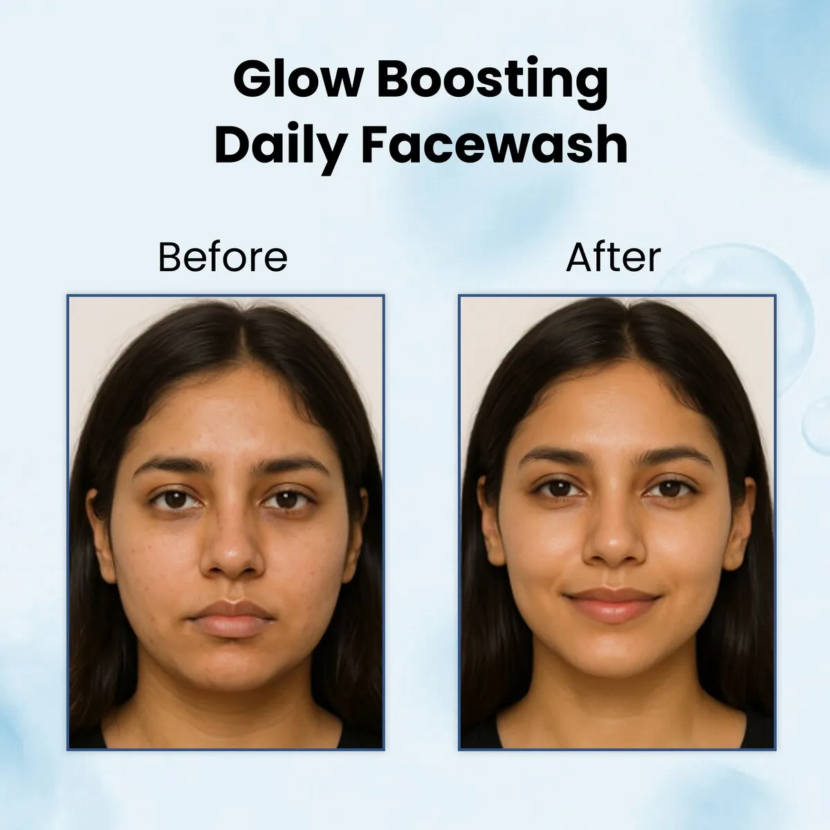 Natually AHA+BHA FaceWash - Glycolic , Salicylic & Hyaluronic Acid - Image 6